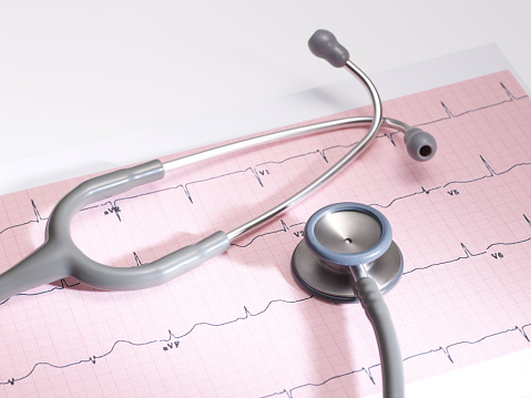A stethoscope on a printout of a cardiogram Chart (ECG)