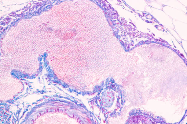 istock Histological Spermatic cord human, Seminal vesicle human, Prostate human and Human chromosomes under the microscope. 1542048683