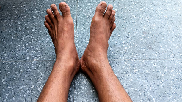 instep, toes, big toe, toe hair, toenails. straighten legs - fungus toenail human foot onychomycosis imagens e fotografias de stock