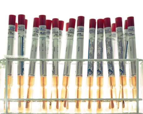 The image shows several flocked swabs in a holder. Flocked swabs are in use for bacteriology samples, virology culture, DNA testing, rapid direct testing and forensic applications.