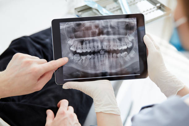 환자 입 디지털 필름을 들고 여자 치과 의사를 닫습니다. 치과 의사는 치과 사무실에서 환자에게 구강에 대해 설명했습니다. - dentist office work tool hygiene mirror 뉴스 사진 이미지