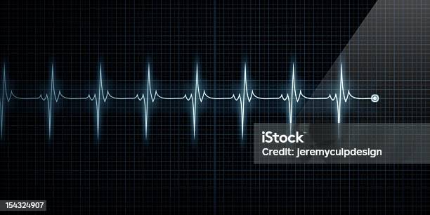 Foto de Monitor De Frequência e mais fotos de stock de Artéria coronária - Artéria coronária, Ataque cardíaco, Coração Humano
