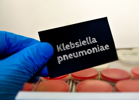 Klebsiella pneumoniae, gram-negative, encapsulated, non-motile bacterium. medical and healthcare conceptual image