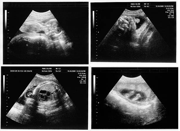 istock child on the ultrasound image 154368238