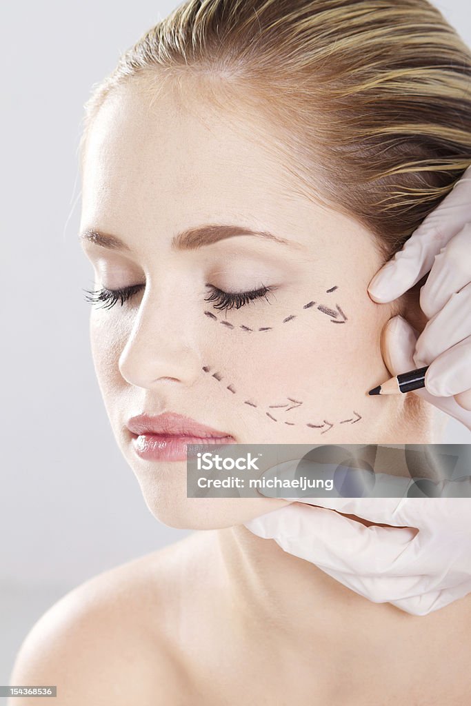 医師修正ラインに描画女性の顔 - 手術のロイヤリティフリーストックフォト