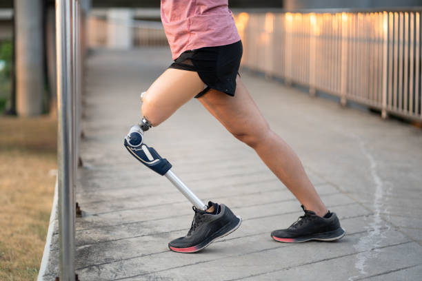 istock Low angle exercise woman with prosthetic leg and stretching in the park 1544913293