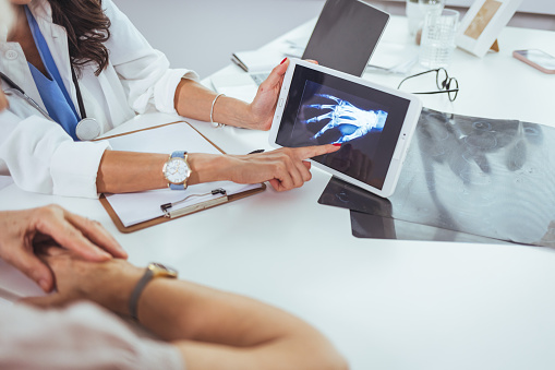 Doctor and patient looking at x-ray and hand in doctor's office. Close-up of female hands holding skiagram. Serious surgeon looking attentively on wrist x-ray and making diagnosis. Traumatology and health care concept