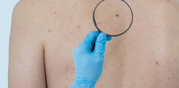 istock Dermatologist examining patient in clinic 1547951287