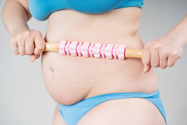 istock Woman with anti-cellulite roller massager on gray background 1548956925