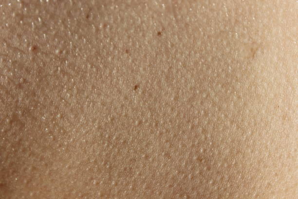 A man's skin with goosebumps and a few water drops.  A few tiny moles or marks.