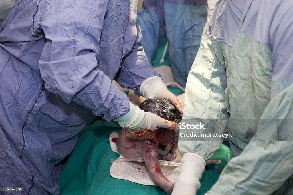 Baby being born by Caesarean Section Baby - Human Age Stock Photo