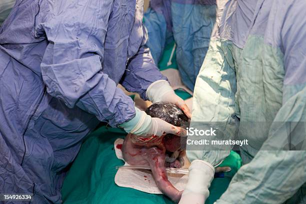 Baby Being Born By Caesarean Section Stock Photo - Download Image Now - Baby - Human Age, Labor - Childbirth, 0-1 Months