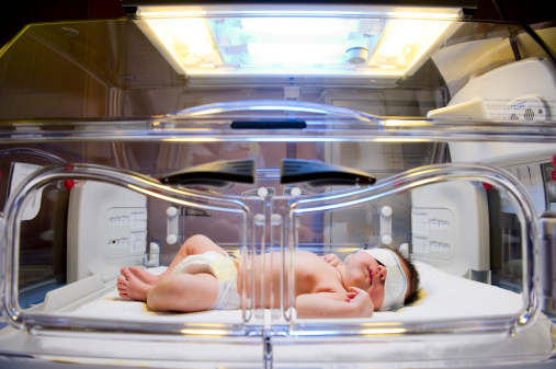 Newborn under the lights in an incubator wearing eye shields
