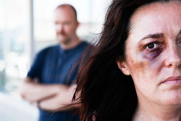 Victim of domestic violence with threatening man in background A beautiful but desperate looking woman, bruised and with a black, eye gazes out at camera. Out of focus in the background, a sinister-looking man lurks, probably the perpetrator of the violence.   bruise photos stock pictures, royalty-free photos & images