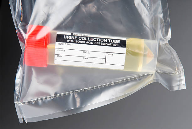 medical amostra de urina - colors liquid small laboratory - fotografias e filmes do acervo