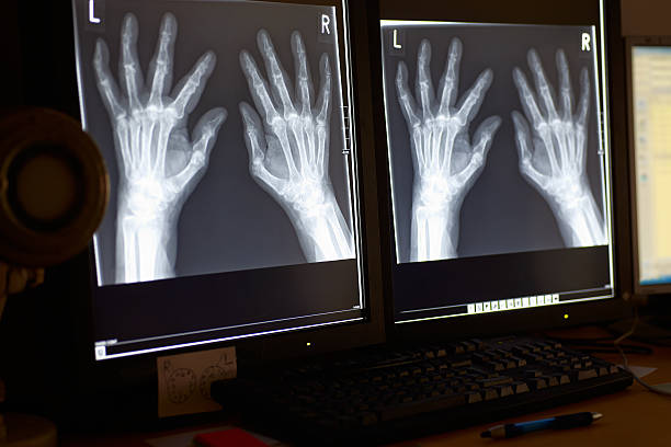 istock X-ray of four hands 154947185