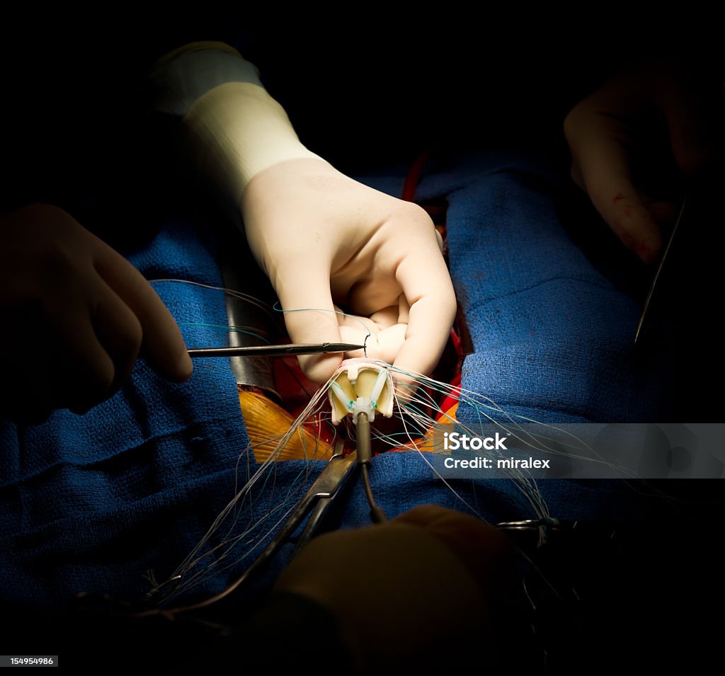 Heart Surgery Aortic Valve Replacement  Heart Valve Stock Photo