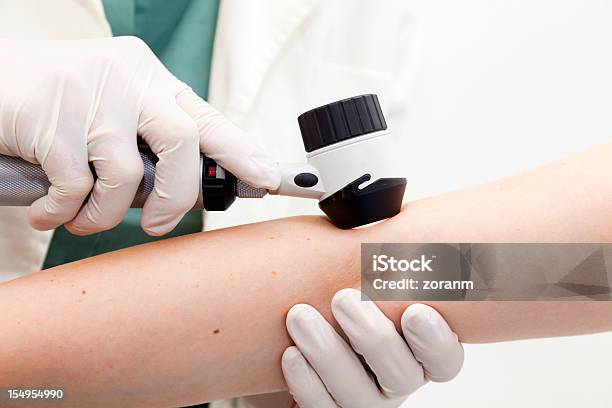 Dermatoskopie Stockfoto und mehr Bilder von Dermatologie - Dermatologie, Ärztliche Untersuchung, Melanom