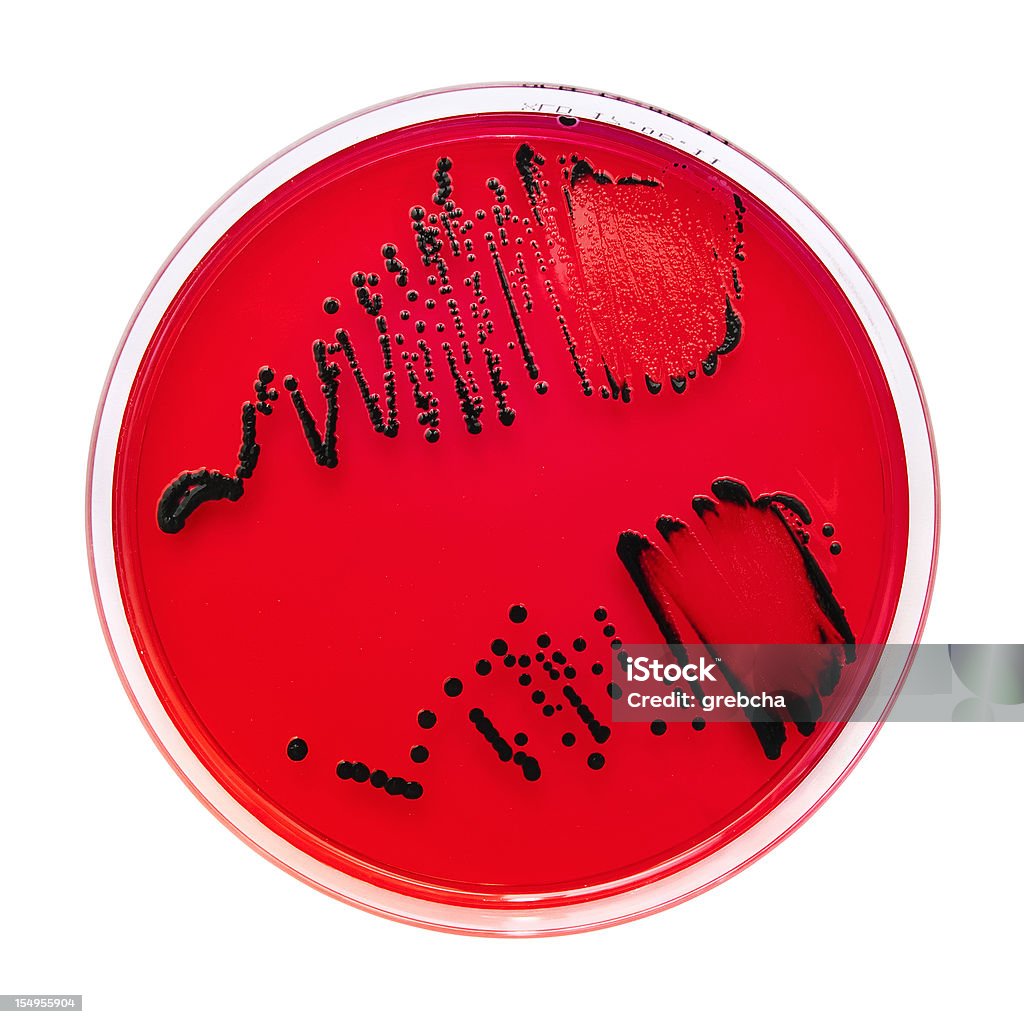 Salmonella spp.XLD ・エイガーに - ウイルスのロイヤリティフリーストックフォト