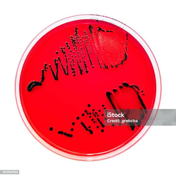 Foto de Salmonella Spp Em Xld Agar e mais fotos de stock de Biologia - Biologia, Ciência, Cor Preta