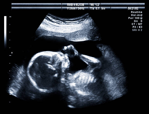 Ultrasound baby sucking on thumb