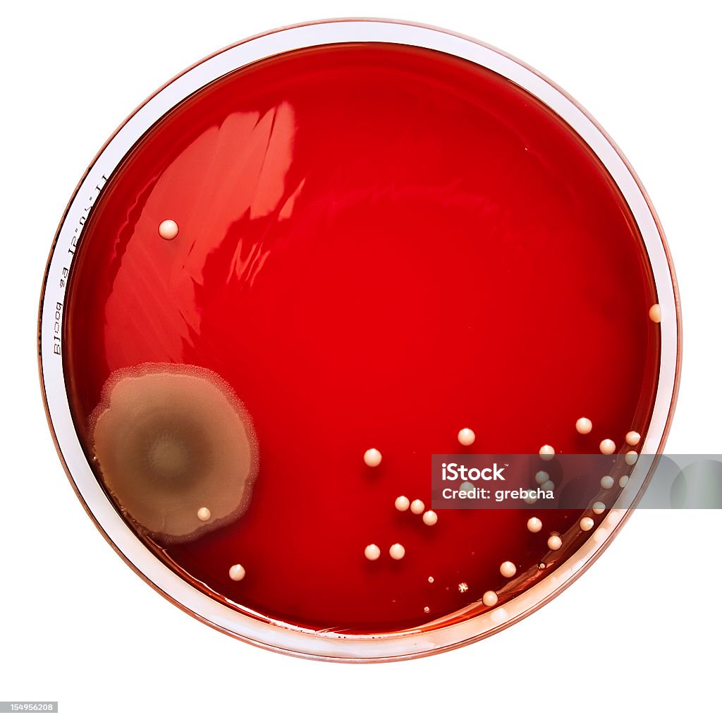 Batteri colonie sul sangue agar - Foto stock royalty-free di Rosso