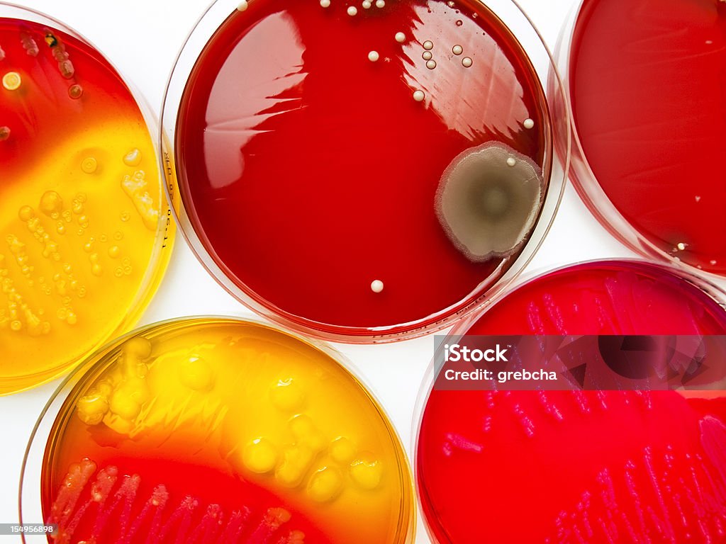 petri блюда с бактериями - Стоковые фото Бактерия роялти-фри