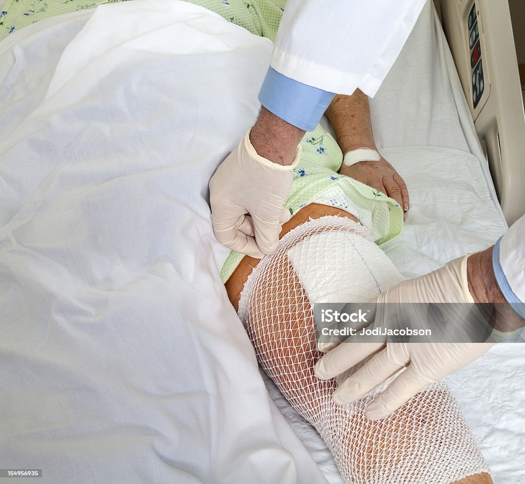 医療: フルニー交換バンデージニット - 人工膝関�節のロイヤリティフリーストックフォト