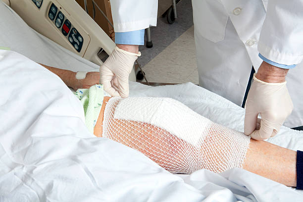 Knee replacement bandage  artificial knee photos stock pictures, royalty-free photos & images
