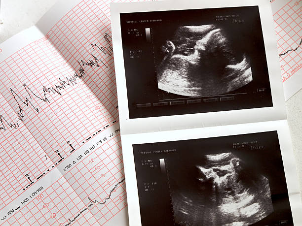 échographie et analuses du foetus - taking pulse photos et images de collection