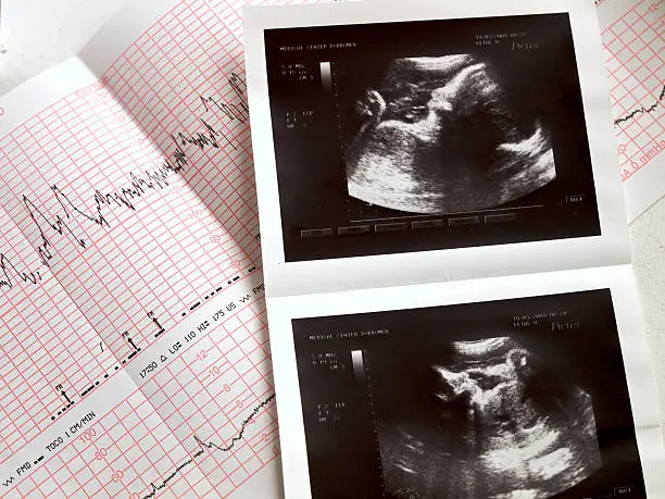ultrasound portrait of the fetus and cardiogram results ,