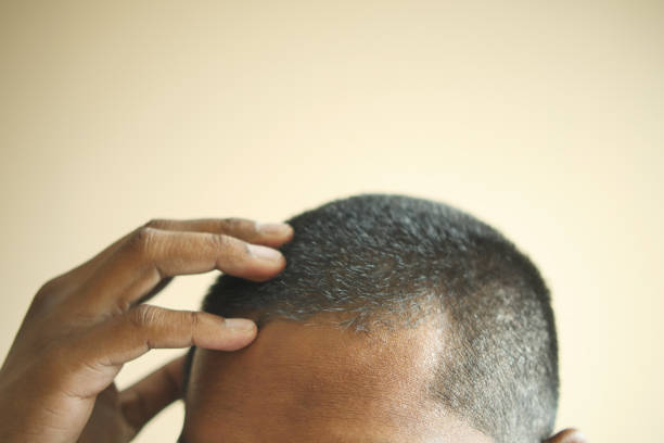 istock hair loss concept with man checking his hair 1550096727