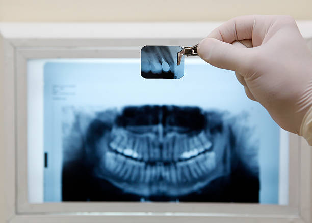 人間の歯 x 線 - 歯 写真 ストックフォトと画像
