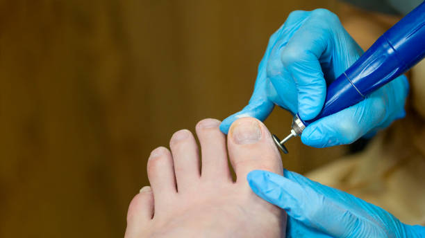 istock Hardware pedicure. Foot and toe treatment 1550608569