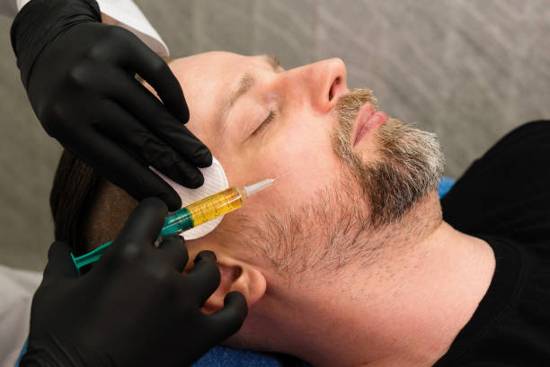 istock PRP therapy and plasma lift treatment 1550609675