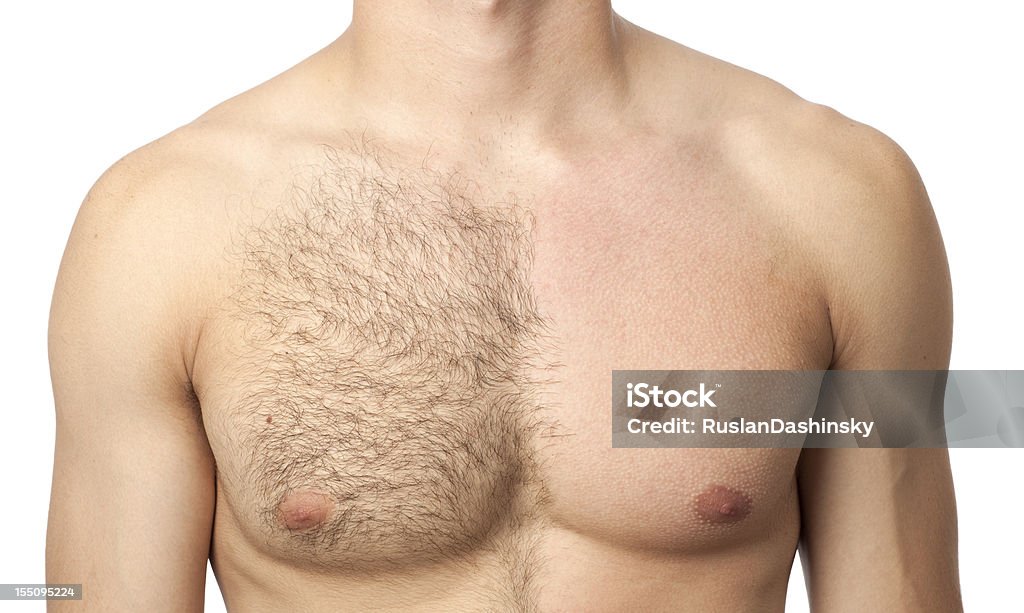 Before & after waxing treatment Portrait of  man chest in waxing treatment. Hair Removal Stock Photo