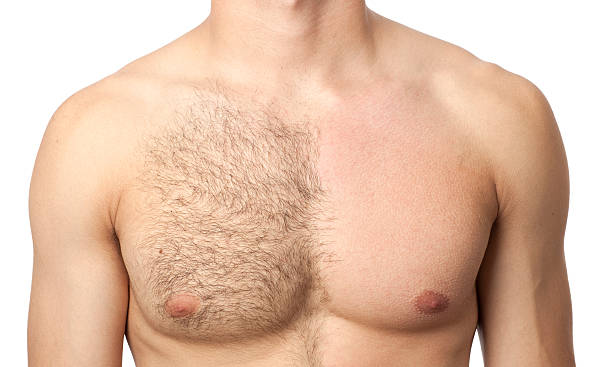 Before & after waxing treatment Portrait of  man chest in waxing treatment. chest torso photos stock pictures, royalty-free photos & images