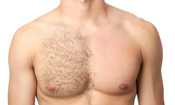 Portrait of  man chest in waxing treatment.