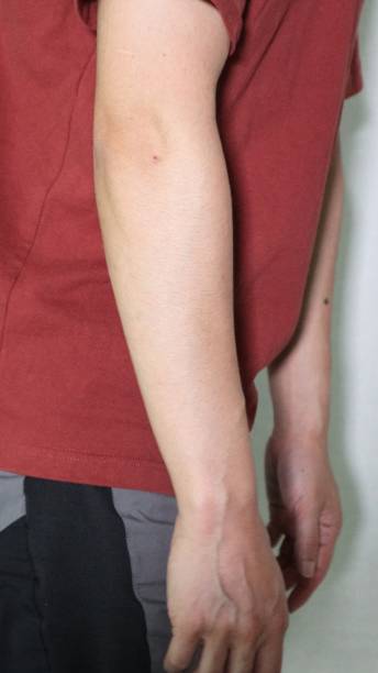 istock Close-up of a stooped person 1550978970