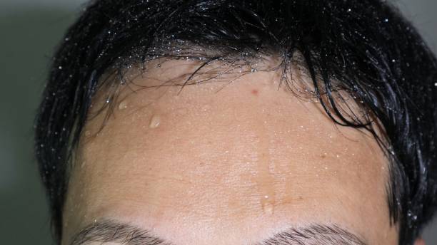 istock Close-up of a sweaty person 1550990109