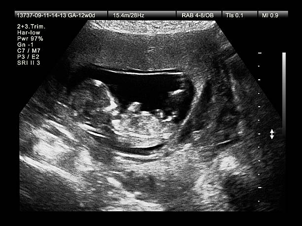 istock Medical Imaging of Fetus 155126921