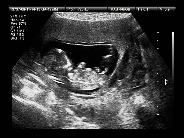 Medical Imaging of Fetus stock photo