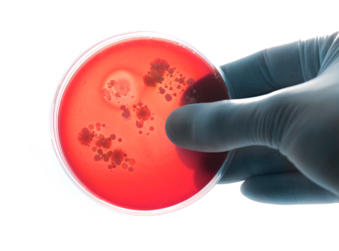A gloved hand with blue latex safety glove holding a blood agar plate with bacteria colonies grown. On white background with back light effect.