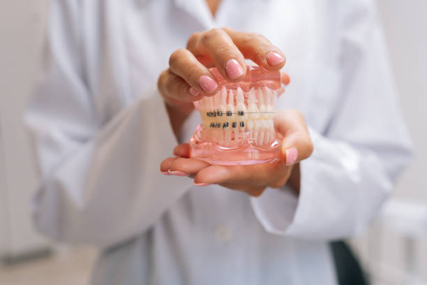 Human jaws layout model with metal dental braces in dentistry clinic - https://media.istockphoto.com/id/1551399132/photo/close-up-hands-of-unrecognizable-female-orthodontist-doctor-in-white-coat-holding-human-jaws.jpg?s=612x612&w=0&k=20&c=cJrNhSZNfqKuE6IBiCQ2vcbkdCZKNLOvf4ZLZEra4SA=