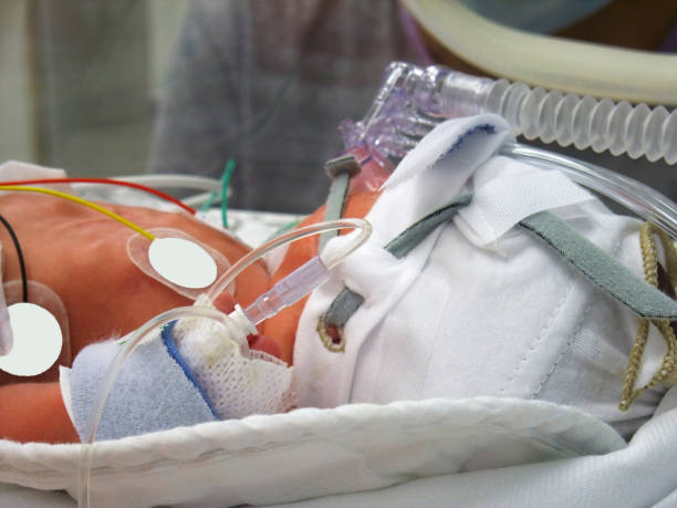 Premature in ICU a few day´s old preemie in hospital lying in an incubator oxygen monitor stock pictures, royalty-free photos & images