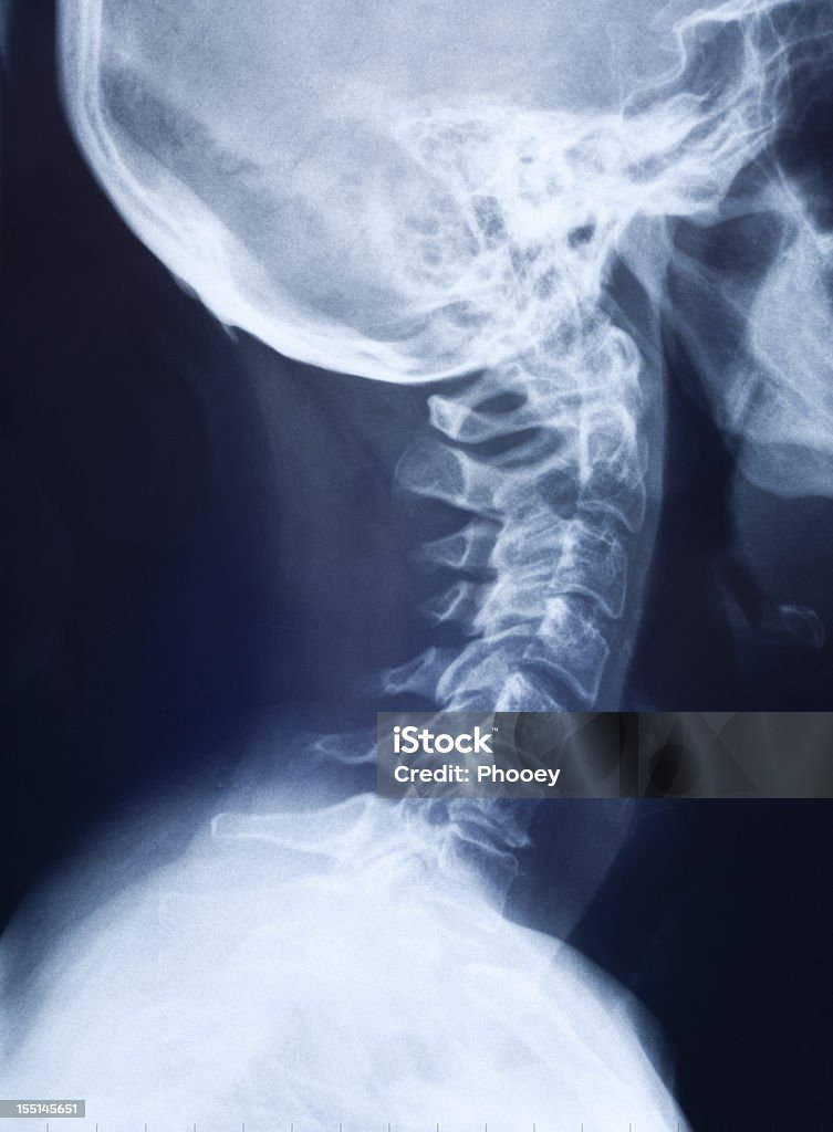 네클 방사선 - 로열티 프리 엑스레이 이미지 스톡 사진