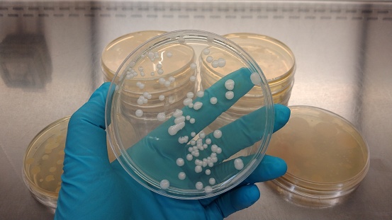 Lady scientist in microbiology laboratory working with E coli culture