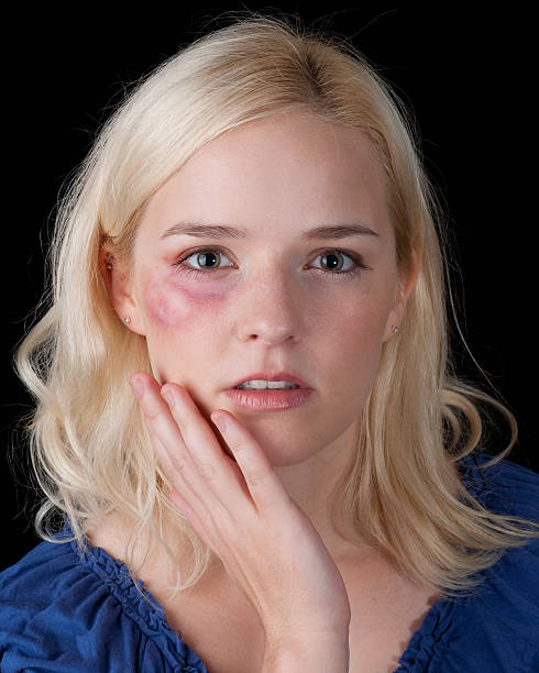 istock Victim of domestic abuse 155249903