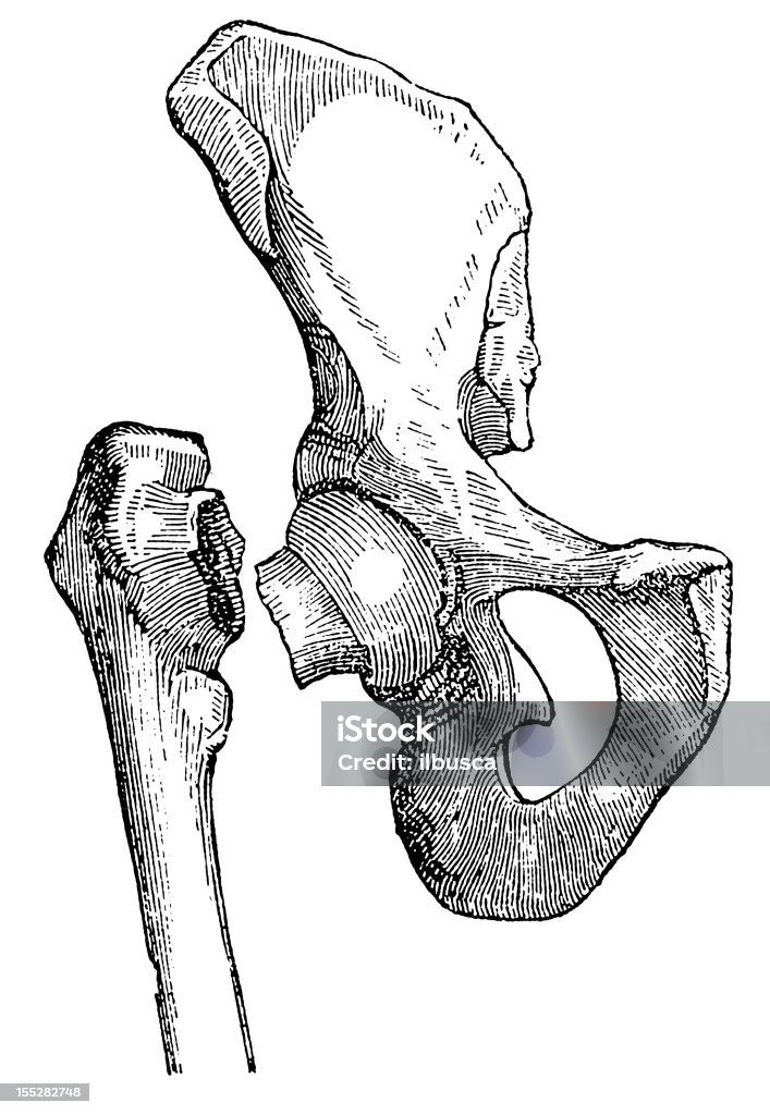 Broken thighbone - Illustration de Adulte libre de droits