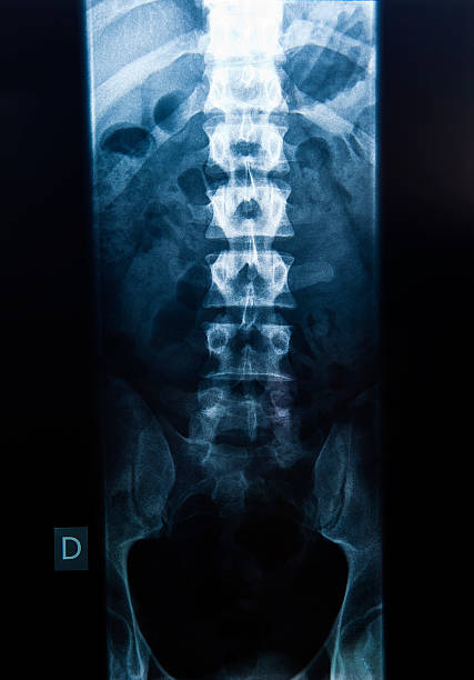 x-ray de um corpo masculino - cat scan pelvis hip human spine - fotografias e filmes do acervo